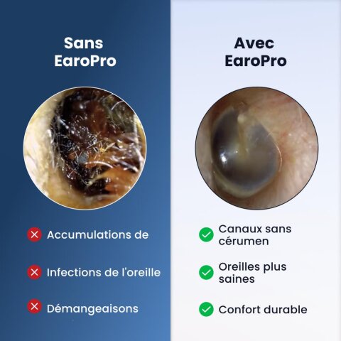 EaroPro image