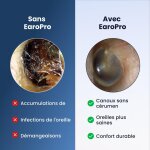 EaroPro image
